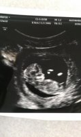 baby#2-12wks.jpg