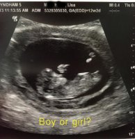 12weekultrasound_baby2_web.jpg