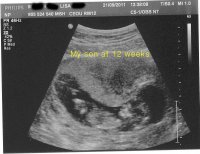 LiamHines_12weeks_web.jpg