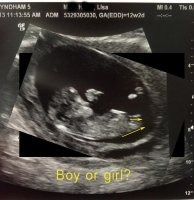 12weekultrasound_baby2_web_edit.jpg