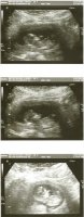 2nd Ultrasound 001.jpg