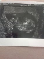 Baby M 10w5d.jpg