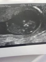 Baby M 11w1d.jpg