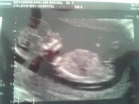 baby scan.jpg