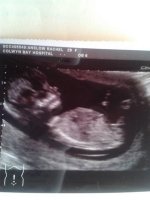 baby scan 2.jpg