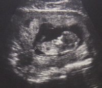 ultrasound12wks2.jpg