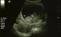 LittleG_Ultrasound_07112013_ZOOMED.jpg