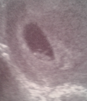 2013-07-17 13.39.52.png