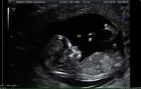 Baby at 12w1d -NB.jpg