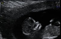 Baby 12w Cute.jpg