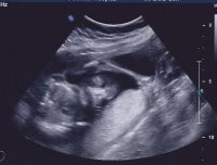 Baby Stevenson 1.jpg