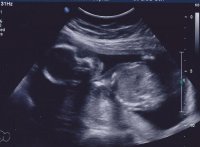 Baby Stevenson 2.jpg