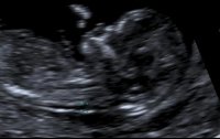 Baby3.jpg