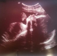 baby @ 7 months.jpg