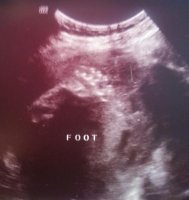 baby feet 7 months.jpg