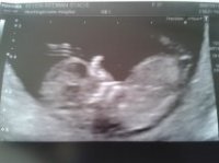 baby scan.jpg