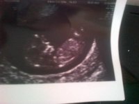 baby scan 12 weeks.jpg