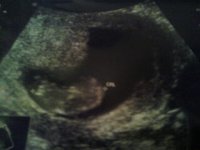 10+3 wk scan.jpg