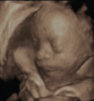 scan3.png