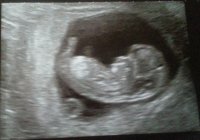 baby 11 week scan crop.jpg