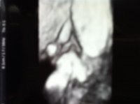 12 wk scan.jpg