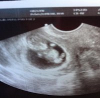 10 weeks.jpg
