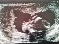 20 week scan - feet.jpg