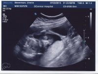 Baby Stevenson 1.jpg