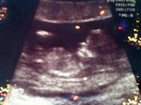 12w+3d Ultrasound w: Baby#2.jpg