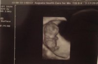 baby9weeks.jpg