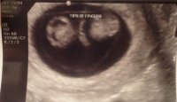 9weeks2.jpg
