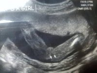 Trini's 20 week gender scan.jpg