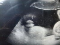 Trini's 39 week scan.jpg