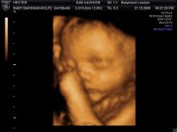 BABYBOND_10.jpg