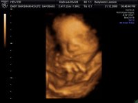 BABYBOND_20.jpg