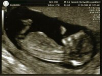 13weeks.jpg