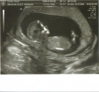 First Scan 13 weeks.jpg