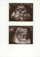 Baby Whalley - Scan 3 and Scan 4.jpg