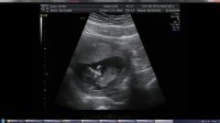 12 WEEKS 3 DAYS.jpg