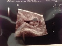 baby 27.8.13.jpg