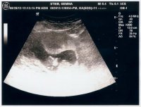 11w4d -2.jpg