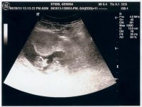 11w4d -3.jpg