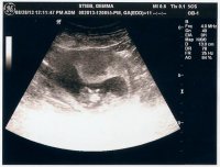 11w4d -1.jpg
