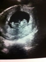 Baby Havers.jpg