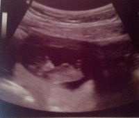 baby ultrasound 105 weeks.jpg