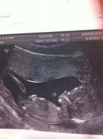 baby1stscan.jpg