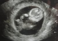 babay.jpg