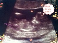 12w+3d Ultrasound w: Baby#2.jpg