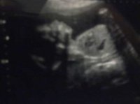maddie scan.jpg