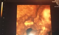 4d scan 26weeks.jpg